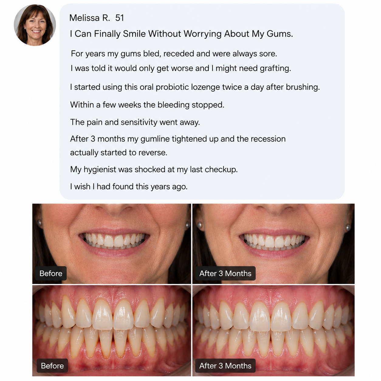 TervaLabs Oral Probiotic Lozenges