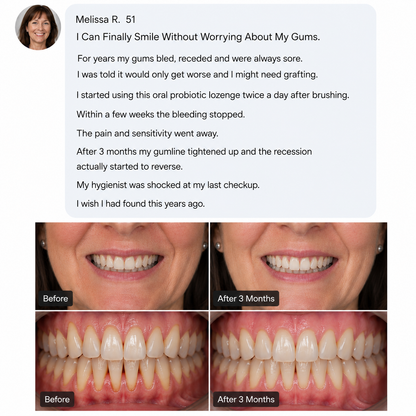 TervaLabs Oral Probiotic Lozenges