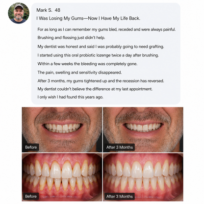 TervaLabs Oral Probiotic Lozenges